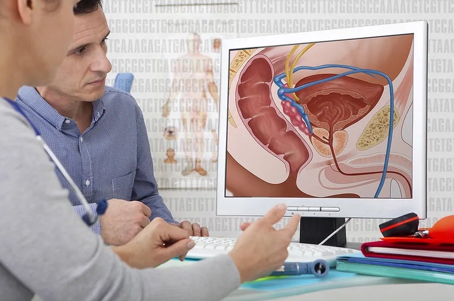 cancer de prostata1 copia